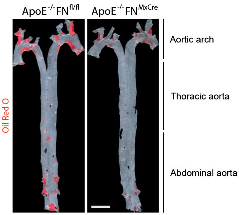 Image of longitudinally opened aortas